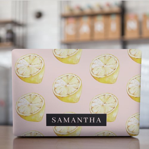 Modern Pink   Yellow Lemons Pattern With Name HP Laptop Skin