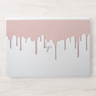 Modern Rose Gold Dripping HP Laptop Skin