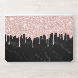 Modern Rose Gold Glitter Drips Dark Marble HP Laptop Skin