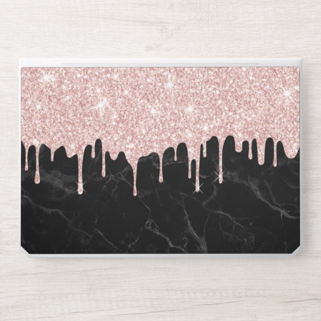 Modern Rose Gold Glitter Drips Dark Marble HP Laptop Skin (Front)
