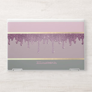 Modern Trendy Pastel Striped,Violet Glitter Drips HP Laptop Skin