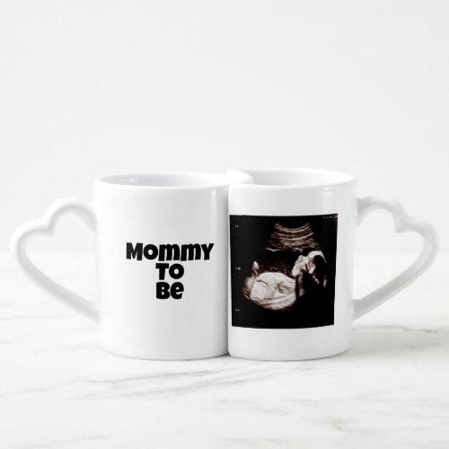 Mommy and Daddy To Be Ultrasound Couples Mugs