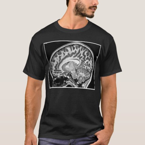 MRI Brain 2 Tshirt