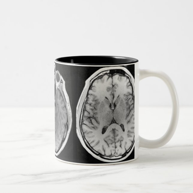 MRI brain image mug (Right)