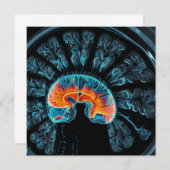 MRI brain scan (Front/Back)