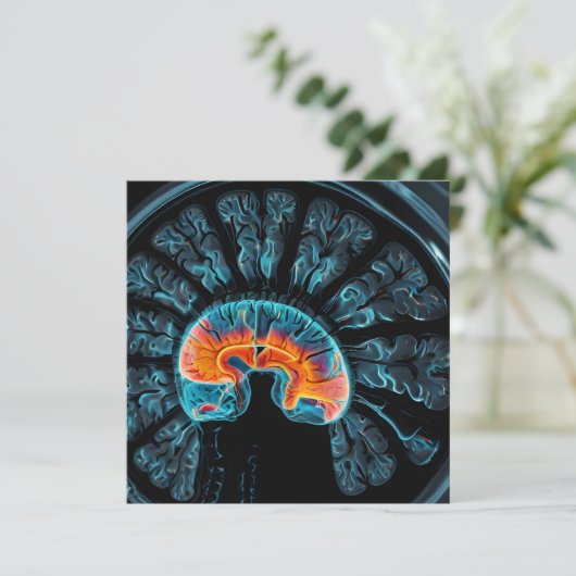 MRI brain scan (Standing Front)