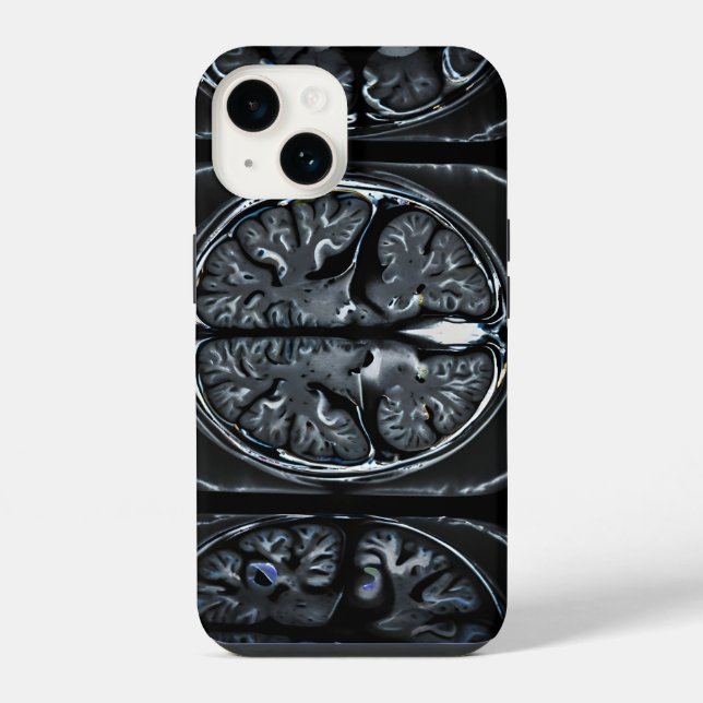 MRI brain scan Iphone Case (Back)