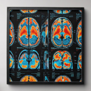 MRI brain scan Peel And Stick Photo Tile
