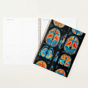MRI brain scan Planner