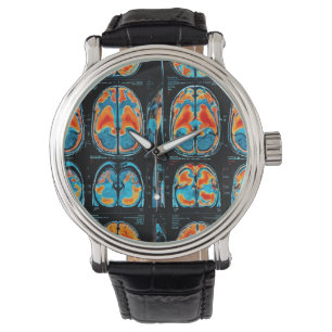 MRI brain scan Watch