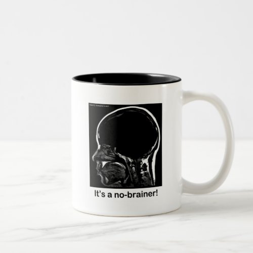 MRI Its a no_brainer Two_Tone Coffee Mug