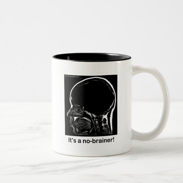 MRI: It's a no-brainer! Two-Tone Coffee Mug (Right)