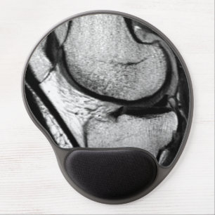 MRI Knee Mousepad