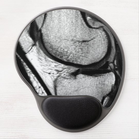 MRI Knee Mousepad