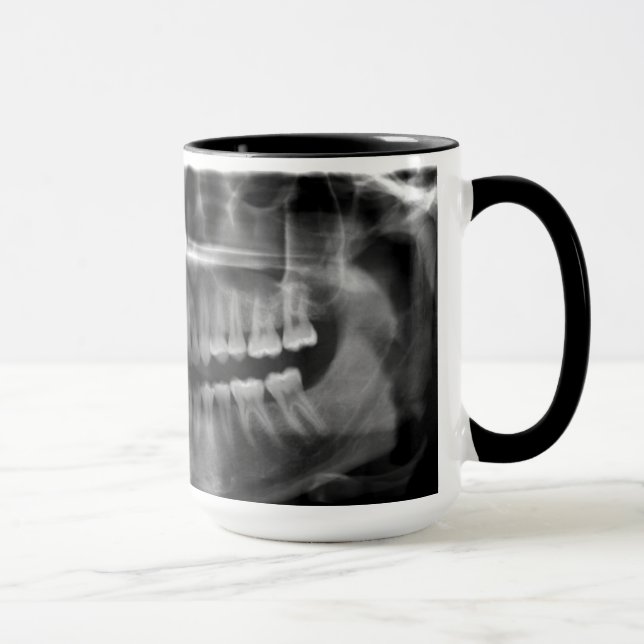 Mug Panoramic X-ray (Right)