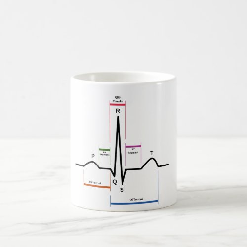 MUG Sinus Rhythm Electrocardiogram ECG Diagram