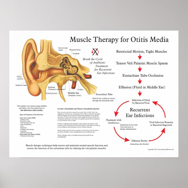Muscle Massage Therapy for Otitis Media Poster (Front)