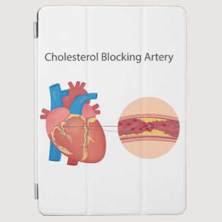 Narrowed blood vessels iPad air cover