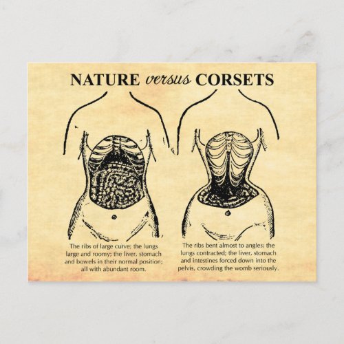 Nature versus Corsets Postcard