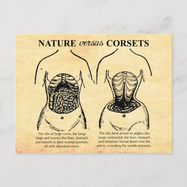 Nature versus Corsets Postcard (Front)