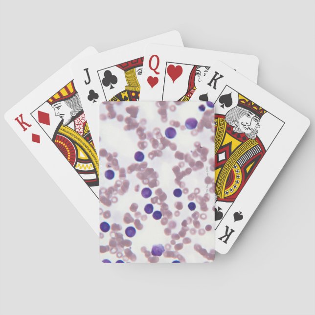 Neoplastic Lymphocyte Cells Poker Cards (Back)
