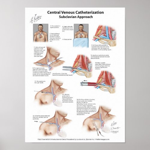 Netter Chart Central Venous Catheterization Poster