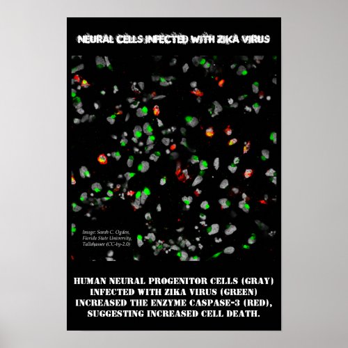 Neural Cells Infected w Zika Poster by RoseWrites