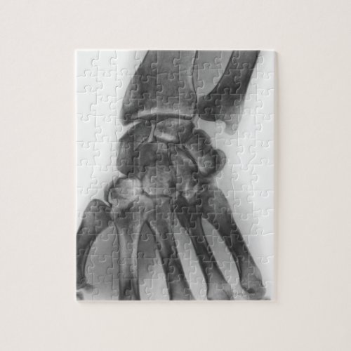 Normal wrist X_ray Jigsaw Puzzle