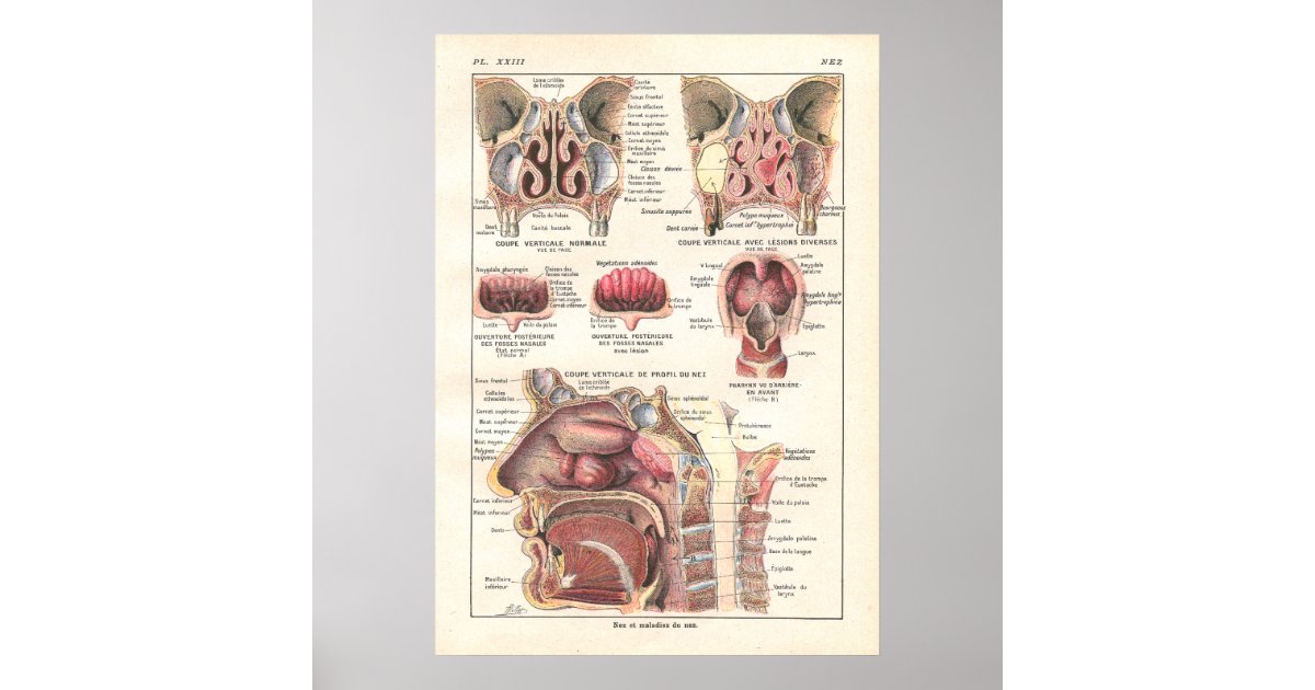 Nose & Sinuses Anatomy Poster in French Zazzle