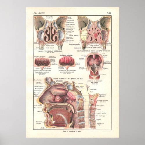 Nose  Sinuses Anatomy Poster in French