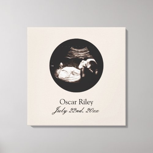 Nursery Art Baby Sonogram Ultrasound Photo Canvas Print