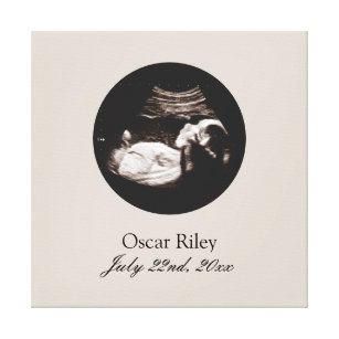 Nursery Art Baby Sonogram Ultrasound Photo Canvas Print