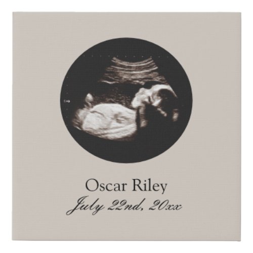 Nursery Art Baby Sonogram Ultrasound Photo Faux Canvas Print