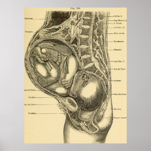 Obstetrics Illustration Poster