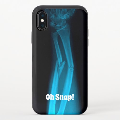 Oh Snap Broken Arm Xray iPhone X Slider Case