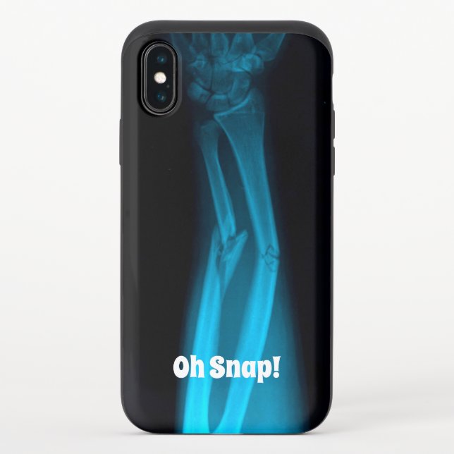 "Oh Snap!" Broken Arm Xray Uncommon iPhone Case (Back)