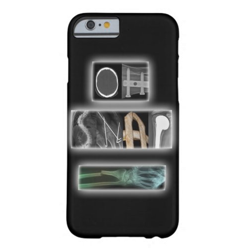Oh Snap iPhone 66s Case