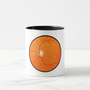 Ophthalmology Optometry Eye Fundus Exam Mug