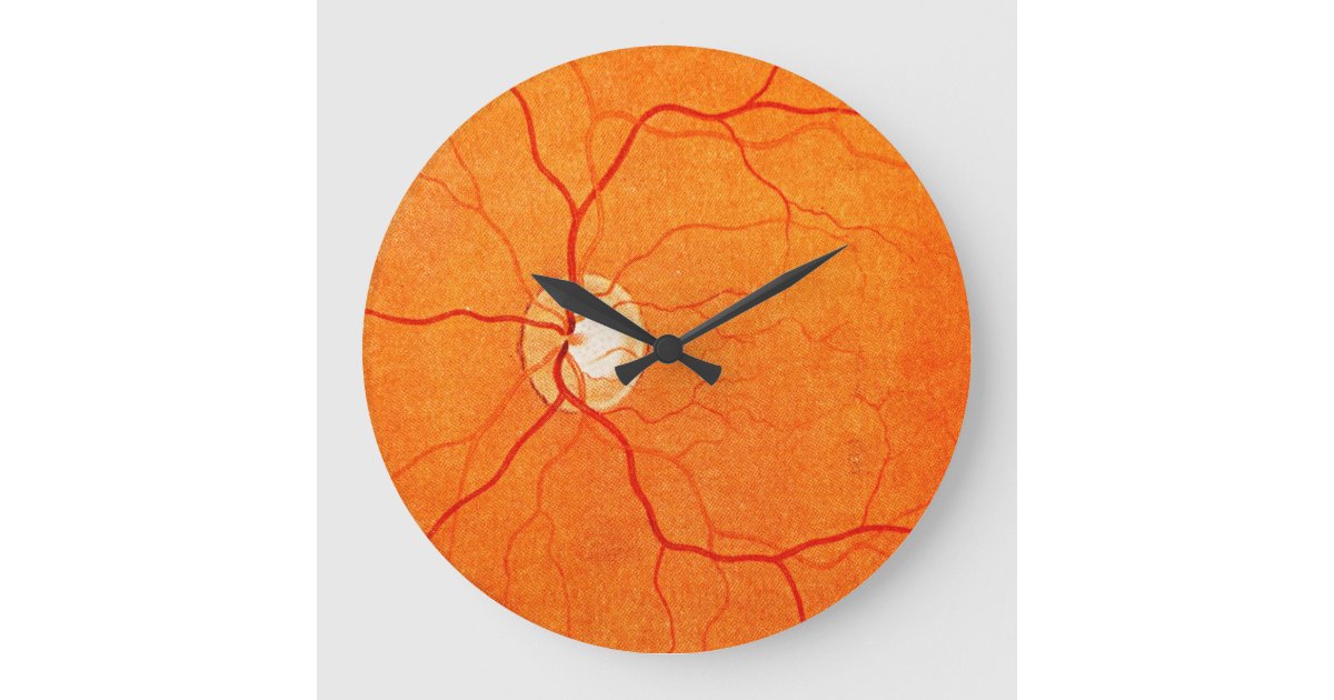 Ophthalmology Optometry Eye Fundus Exam Wall Clock Zazzle