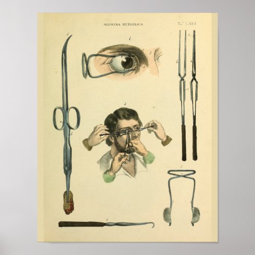 Optometry Eye Surgery Medical Art Print