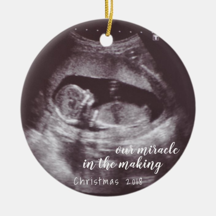 sonogram christmas ornament