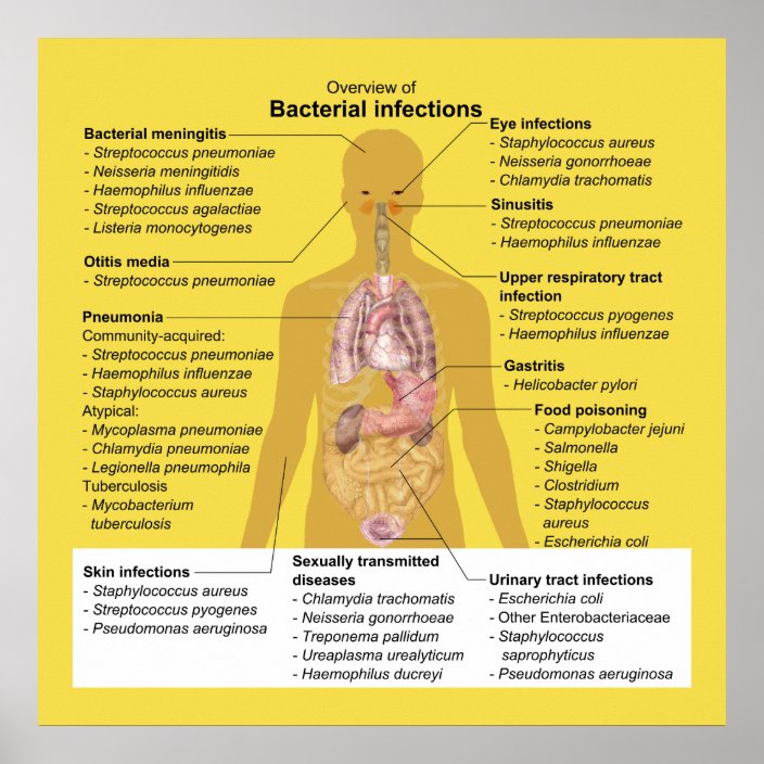 overview-of-bacterial-infections-poster-zazzle