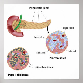 Pancreatic islet and diabetes Poster
