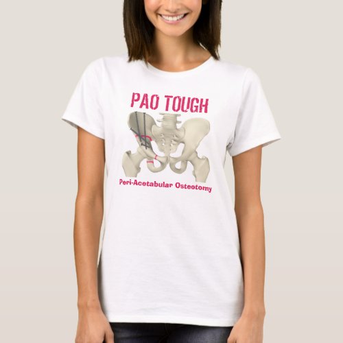 PAO TOUGH Peri_Acetabular Osteotomy t_shirt