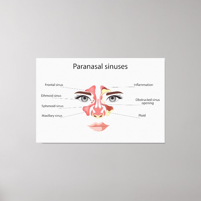 Paranasal sinuses  canvas print (Front)