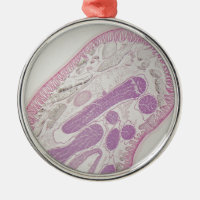 Parasitic nematode worm (Ascaris sp.)