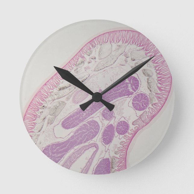 Parasitic nematode worm (Ascaris sp.) Round Clock (Front)
