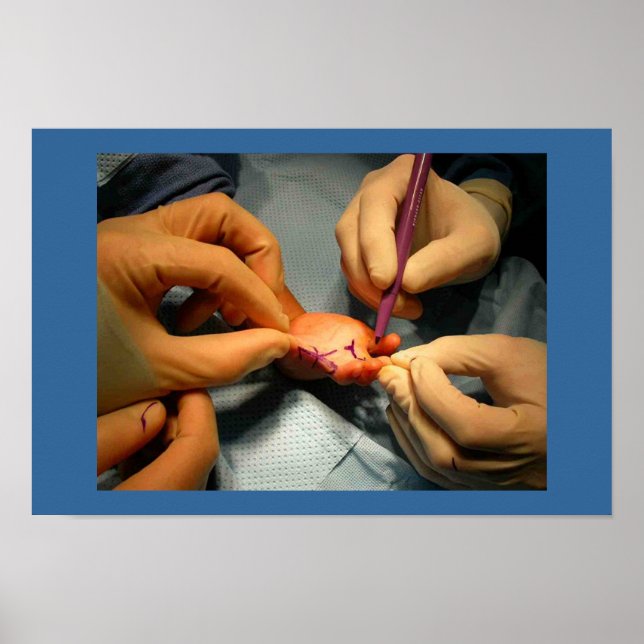 Pediatric Hand Surgery Poster (Front)