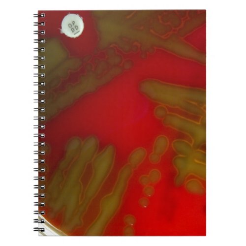 Penumonia Bacteria Notebook