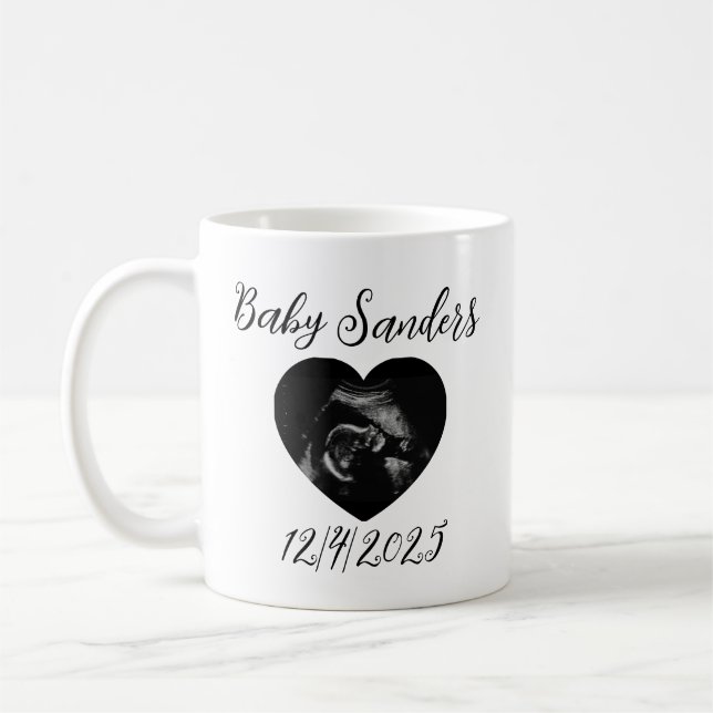 Personalized Baby Sonogram Mug – Custom Ultrasound (Left)